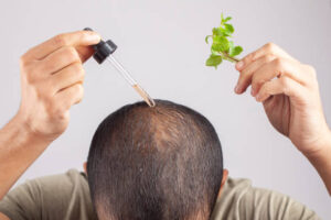 The Best Natural Oils for Effectively Treating Hair Loss